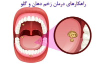 راهکارهای خانگی برای درمان زخم دهان و گلو