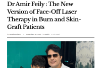 گام تازه در ترمیم پوست سوختگی؛ London Daily Post از موفقیت‌های لیزر Face-Off دکتر امیر فیلی نوشت